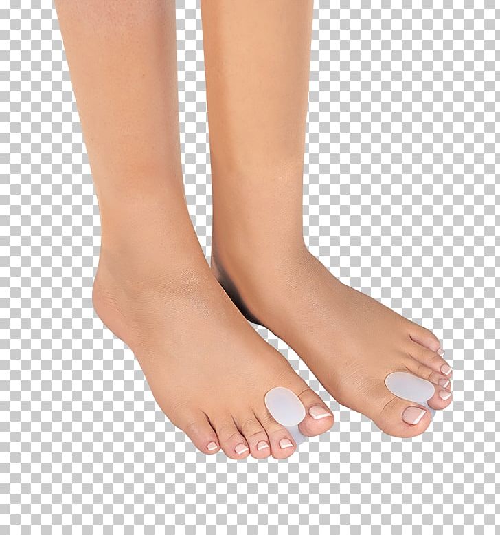 Toe Bunion Foot Shoe Flat Feet PNG, Clipart,  Free PNG Download