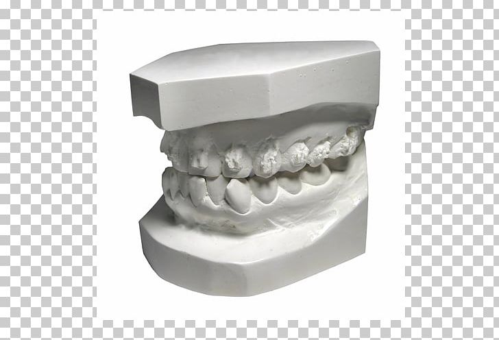 Dentistry Human Tooth PNG, Clipart, Dental Hygienist, Dentistry, Human Tooth, Jaw, Tooth Free PNG Download