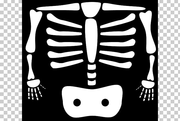 X-ray Generator PNG, Clipart, Black, Black And White, Blog, Bone, Cartoon Free PNG Download