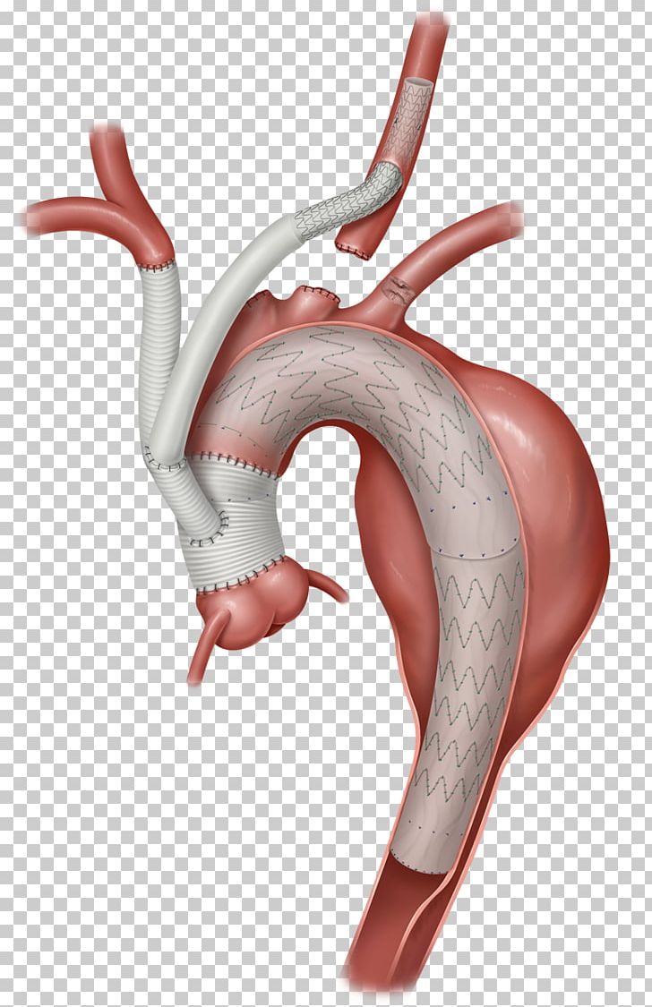 Centaline Property Agency IPod Touch Apple App Store PNG, Clipart, Abdominal Aorta, Antler, Apple, App Store, Cardiac Surgery Free PNG Download