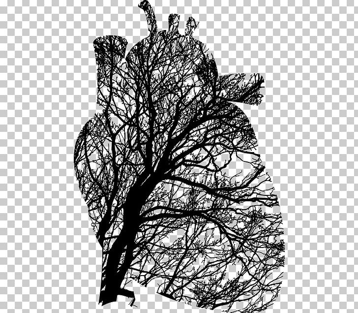 Lung Heart PNG, Clipart, Anatomy, Aorta, Black And White, Branch, Breathing Free PNG Download