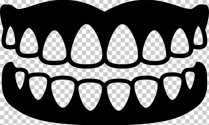 Dentures Dental Implant Dentistry Tooth PNG, Clipart, Artwork, Black, Black And White, Computer Icons, Crown Free PNG Download