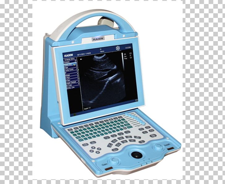 Medical Equipment Ultrasound Animal Medicine PNG, Clipart, Animal, Com, Communication, Dicom, Electronic Device Free PNG Download