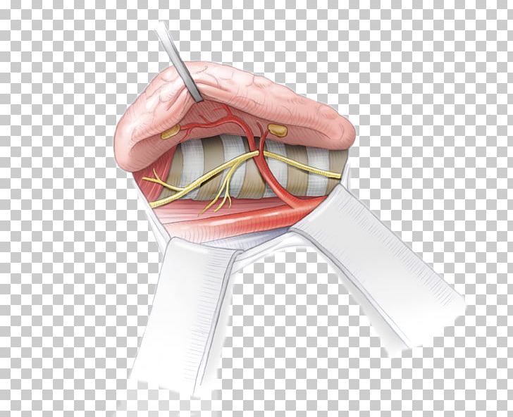 Parathyroid Gland Recurrent Laryngeal Nerve Human Anatomy PNG, Clipart, Anatomy, Finger, Gland, Human Anatomy, Hyperparathyroidism Free PNG Download