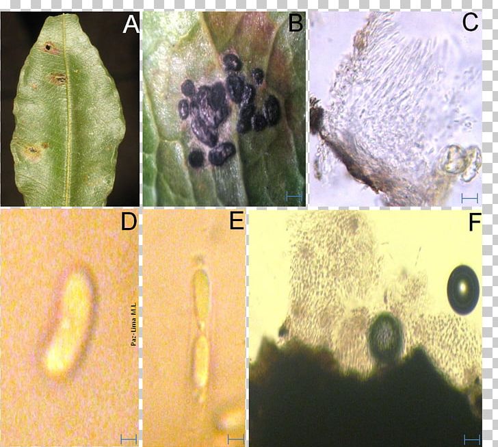 Colletotrichum Sordariomycetes Plant Pathology Fungus PNG, Clipart, Acervulus, Canker, Colletotrichum, Disease, Fauna Free PNG Download