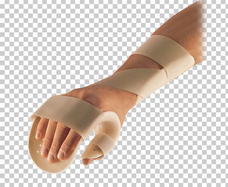 Thumb Orthotics Finger Hand Wrist PNG, Clipart, Adaptation, Arm, Finger, Foot, Hand Free PNG Download