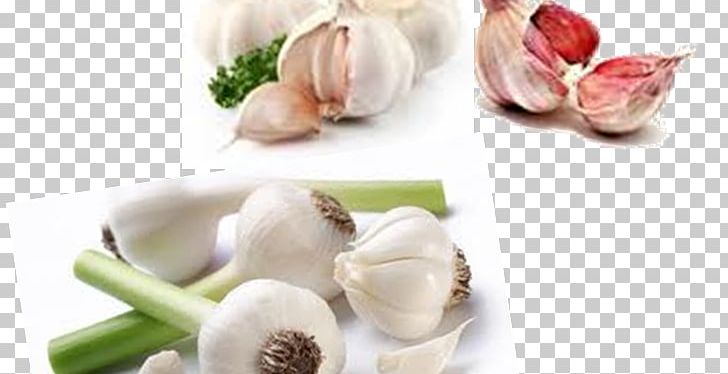 Garlic Broccoli Vegetarian Cuisine Organic Food Vegetable PNG, Clipart, Artichoke, Broccoli, Diet Food, Flavor, Food Free PNG Download