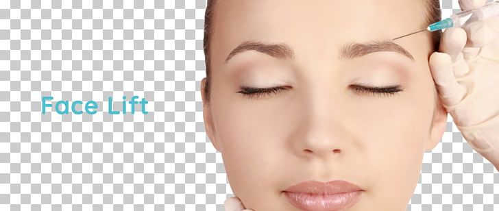 Botulinum Toxin Wrinkle Injection Anti-aging Cream Injectable Filler PNG, Clipart, Ageing, Antiaging Cream, Beauty, Cheek, Chin Free PNG Download