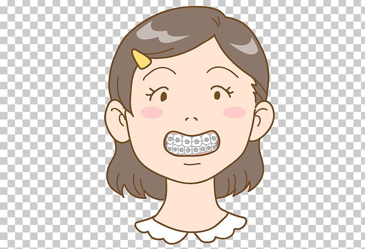 Dentistry Dental Braces Dentition 矯正歯科 PNG, Clipart, Boy, Cartoon, Child, Chin, Clear Aligners Free PNG Download