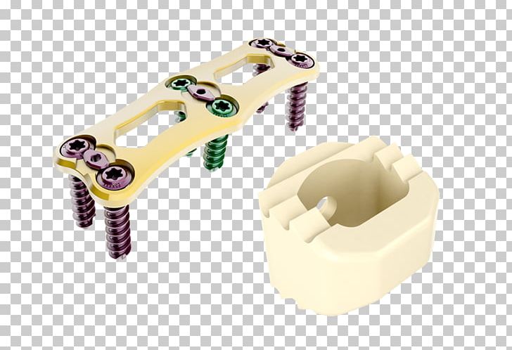 Cervical Vertebrae Implant Vertebral Column Spinal Cord Stimulator PNG, Clipart, Ceramic, Cervical Vertebrae, Hardware, Implant, Intervertebral Disc Arthroplasty Free PNG Download