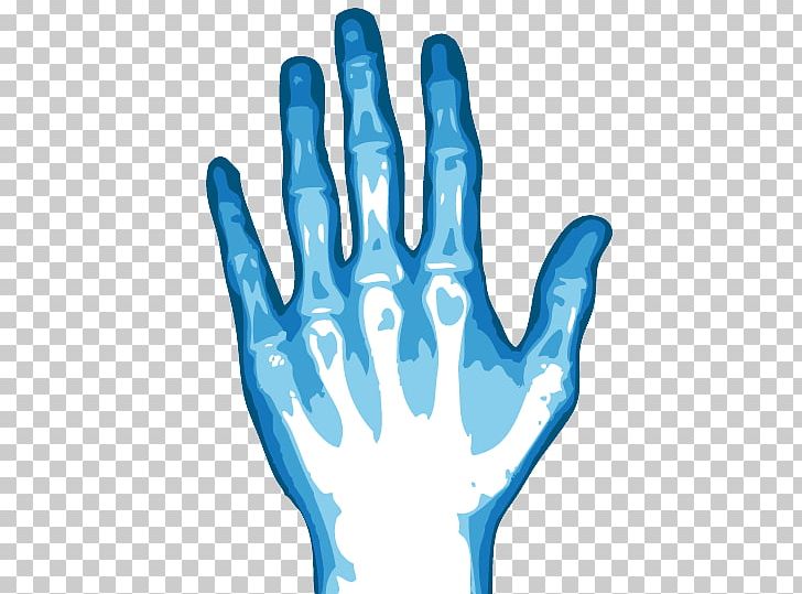 X-ray Hand PNG, Clipart, Clip Art, Computer Icons, Finger, Foot, Hand Free PNG Download