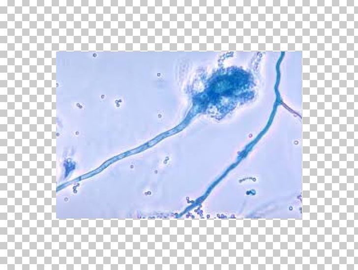 Aspergillus Fumigatus Fungus Aspergillosis Aspergilloma Infection PNG, Clipart, Aspergillosis, Aspergillus, Aspergillus Fumigatus, Aspergillus Niger, Blue Free PNG Download