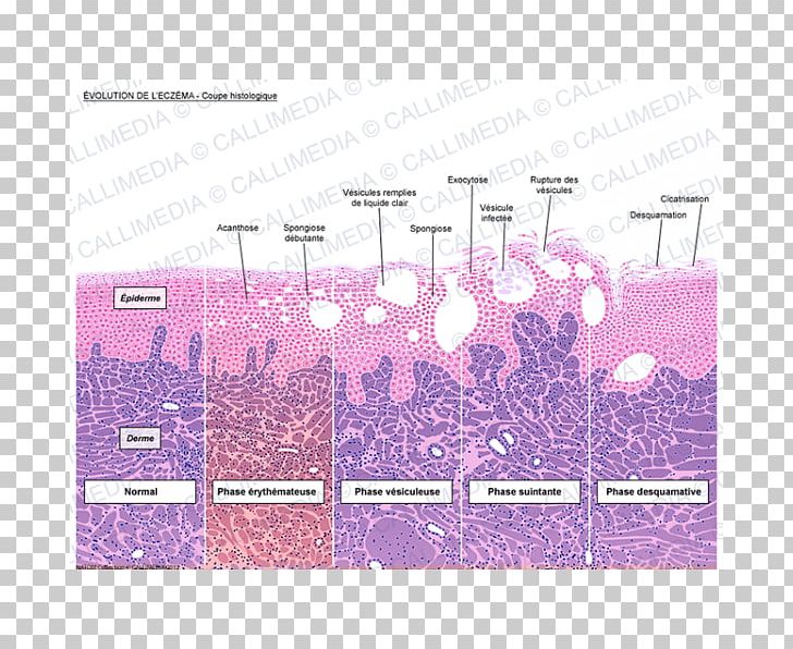 Introduction To Histology Dermatitis Keratinocyte Corte Histológico PNG, Clipart, Angle, Biology, Brand, Cell, Contact Dermatitis Free PNG Download