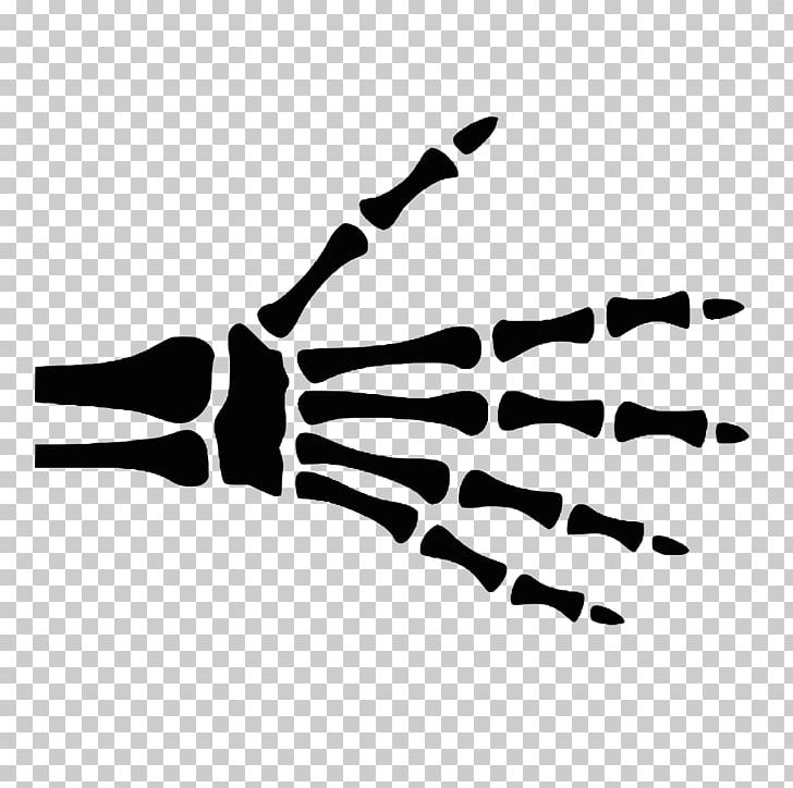 Hand Finger Radiographic Anatomy Bone PNG, Clipart, Anatomy, Angle, Black, Black And White, Bone Free PNG Download