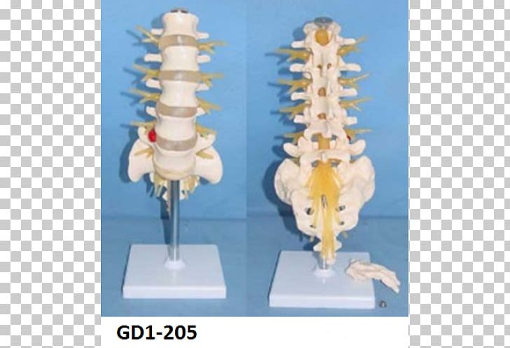 Cauda Equina Spinal Nerve Vertebral Column Lumbar Vertebrae PNG, Clipart, Bone, Cauda Equina, Cauda Equina Syndrome, Conus Medullaris, Human Body Free PNG Download