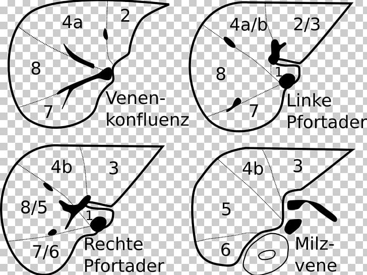 Liver Segment Anatomy Сегменты печени Portal Vein PNG, Clipart, Anatomy, Angle, Area, Biology, Black And White Free PNG Download