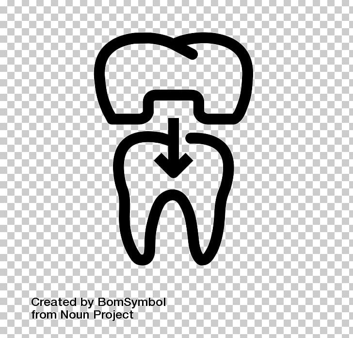 Crown Dentistry Tooth Bridge PNG, Clipart, Abutment, Area, Black And White, Body Jewelry, Bridge Free PNG Download