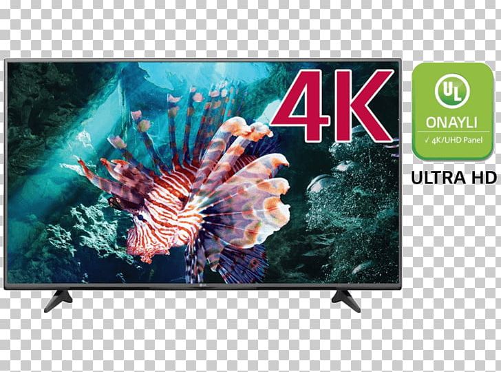 4K Resolution LG Ultra-high-definition Television LED-backlit LCD PNG, Clipart, 4k Resolution, Advertising, Banner, Display Advertising, Display Device Free PNG Download
