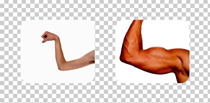 Muscle Weakness Arm Human Body PNG, Clipart, Abdomen, Arm, Autism, Chest, Elbow Free PNG Download