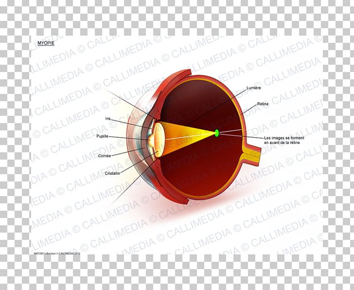 Far-sightedness Ophthalmology Presbyopia Macular Degeneration Eye PNG, Clipart, Angle, Circle, Degeneration, Eye, Eyewear Free PNG Download