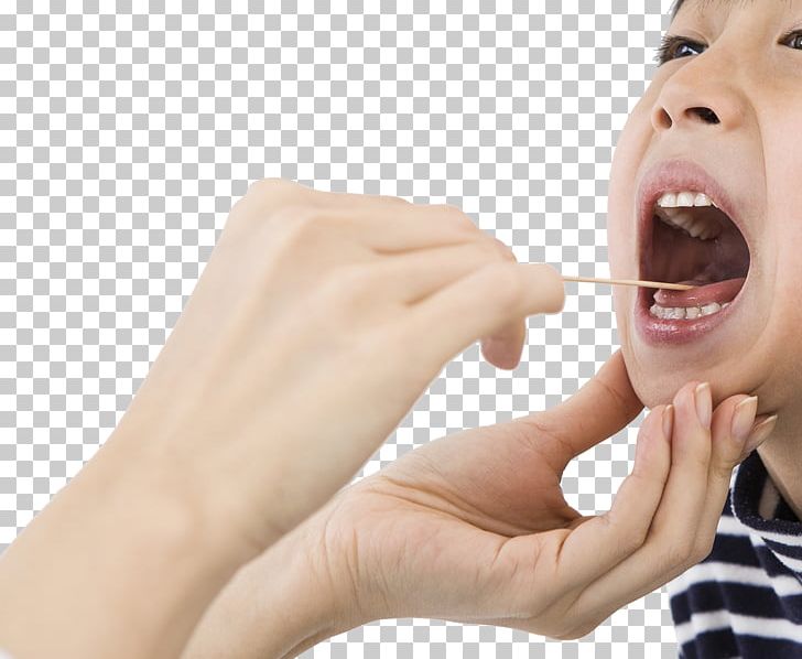 Dentistry Stomatitis Photography PNG, Clipart, Adult Child, Child, Chin, Decay, Decay Free PNG Download