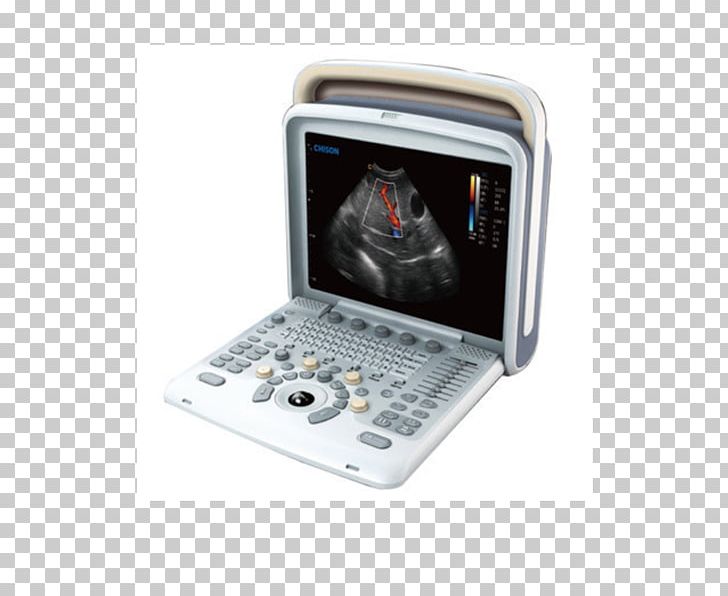 Ultrasonography Portable Ultrasound Doppler Echocardiography Medical Imaging PNG, Clipart, 3d Ultrasound, Cardiology, Computed Tomography, Contrast Resolution, Electronics Free PNG Download