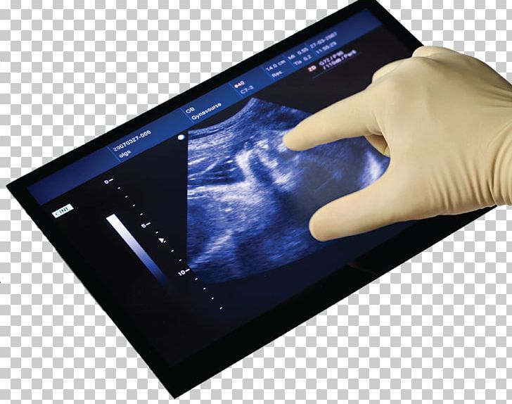 Display Device Touchscreen Capacitive Sensing Human Interface Device User Interface PNG, Clipart, Capacitive Sensing, Computer Monitors, Electronic Device, Electronics, Gadget Free PNG Download