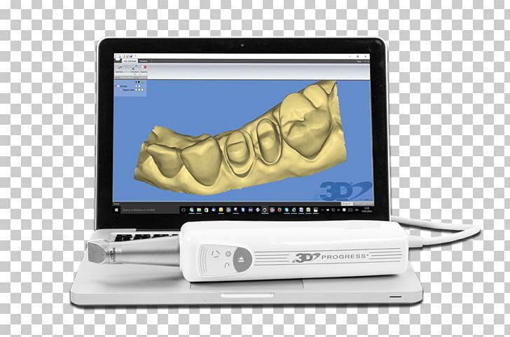 3D Scanner Scanner 3D Computer Graphics Three-dimensional Space Scansione PNG, Clipart, 3d Computer Graphics, 3d Printing, 3d Scanner, Brand, Computer Software Free PNG Download