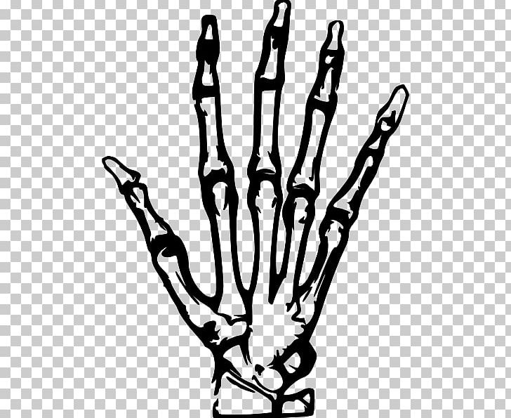 Hand X-ray PNG, Clipart, Black And White, Bone, Branch, Download, Favicon Free PNG Download