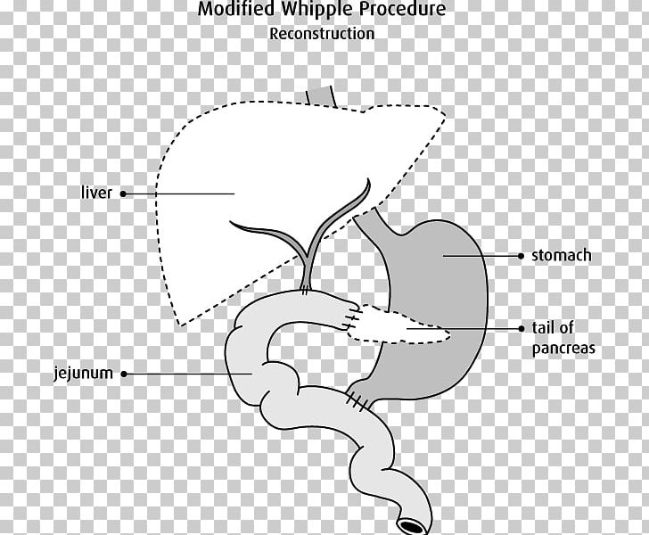 Ear Mouth Jaw PNG, Clipart, Angle, Animal, Area, Arm, Black And White Free PNG Download
