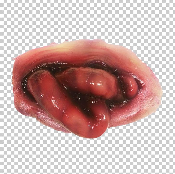 Small Intestine Prosthetic Makeup Special Effects Gastrointestinal Tract Lip PNG, Clipart, Airbrush, Bleeding, Clothing, Costume, Film Free PNG Download