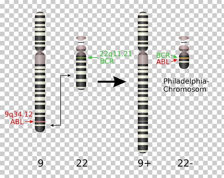 Philadelphia Chromosome Chromosomal Translocation Chronic Myelogenous Leukemia Chromosome Abnormality PNG, Clipart,  Free PNG Download