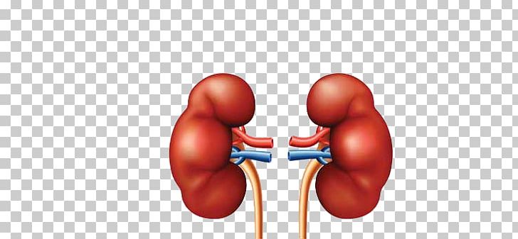 Chronic Kidney Disease Detoxification Liver Kidney Failure PNG, Clipart, Abdomen, Arm, Artery, Boxing Equipment, Boxing Glove Free PNG Download