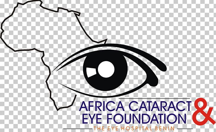 Eye Vision Science Cataract Ophthalmology Blindness PNG, Clipart, Artwork, Black And White, Blindness, Cataract, Circle Free PNG Download