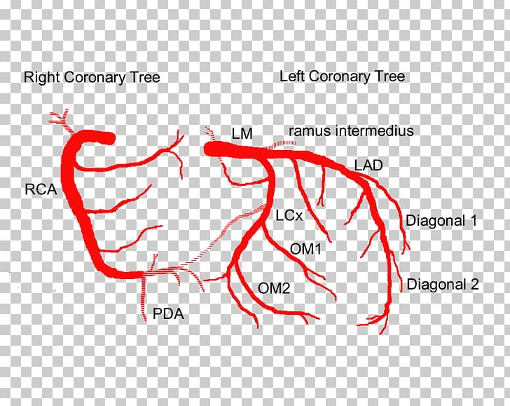 Coronary Arteries Left Coronary Artery Heart Anatomy PNG, Clipart, Angle, Area, Artery, Brand, Coronary Artery Bypass Surgery Free PNG Download