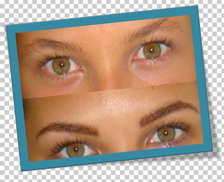 Consultorios Dermatològicos Dra. Squaglia Eyebrow Permanent Makeup Make-up PNG, Clipart, Ache, Aesthetic Medicine, Beauty, Cheek, Chin Free PNG Download