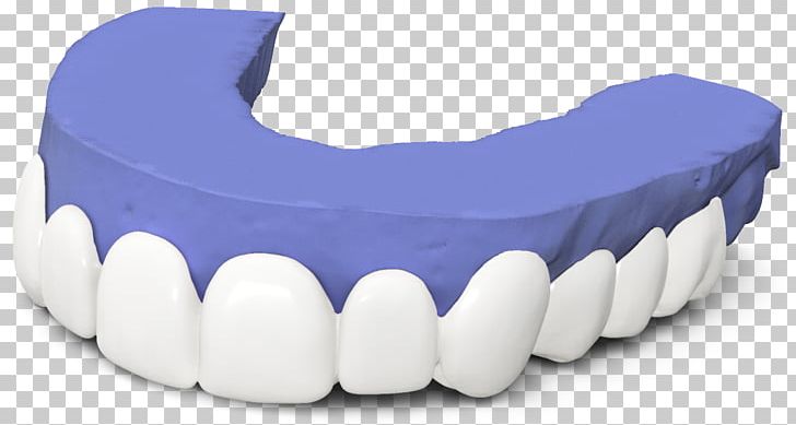 Tooth Veneer Dentistry Dental Laboratory PNG, Clipart, Cadcam Dentistry, Dental Laboratory, Dentist, Dentistry, Human Tooth Free PNG Download