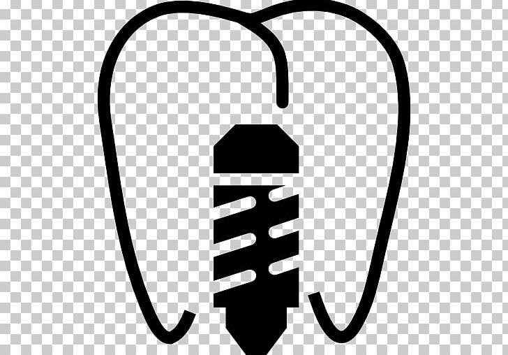 Dental Implant Dentistry 歯科 PNG, Clipart, Black And White, Dental Implant, Dental Surgery, Dentist, Dentistry Free PNG Download