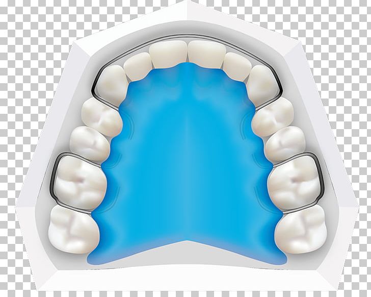 Tooth Orthodontics Dental Braces Dentistry Orthodontist PNG, Clipart, Adolescence, Brace, Bright Smile Orthodontics, Child, Deciduous Teeth Free PNG Download