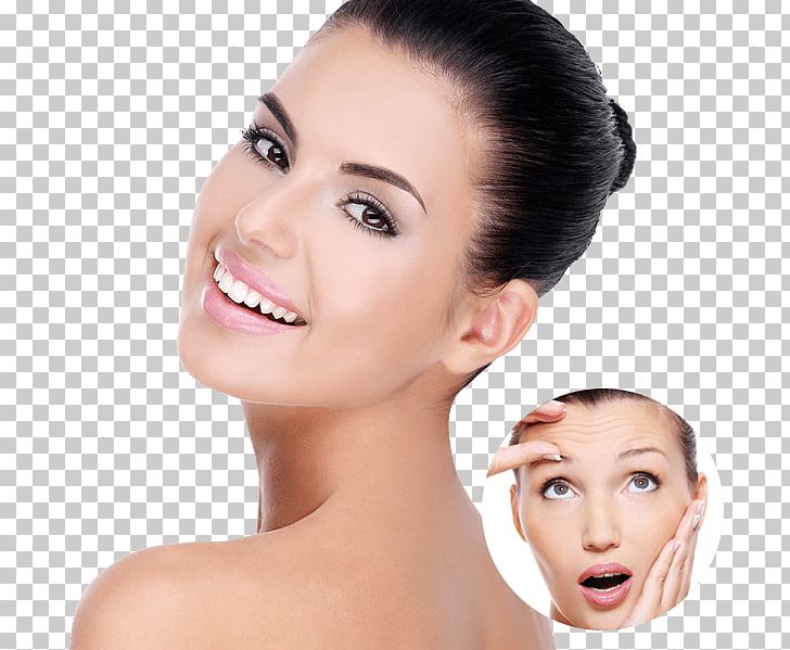 Surgery Wrinkle Face Dermatology Therapy PNG, Clipart, Acne, Beauty, Cheek, Chin, Clean Skin Free PNG Download