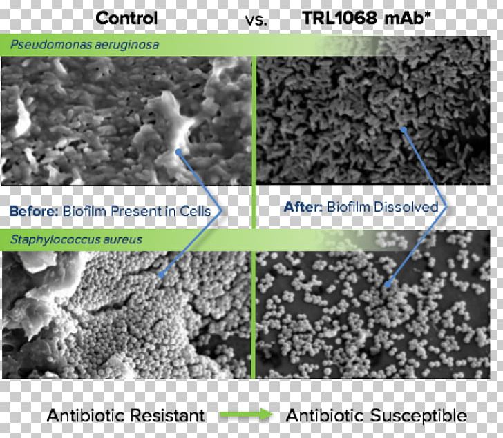 Soil Bacteria Antibody Broad-spectrum Antibiotic Chemical Affinity PNG, Clipart, Antibody, Bacteria, Broadspectrum Antibiotic, Chemical Affinity, Drug Resistance Free PNG Download