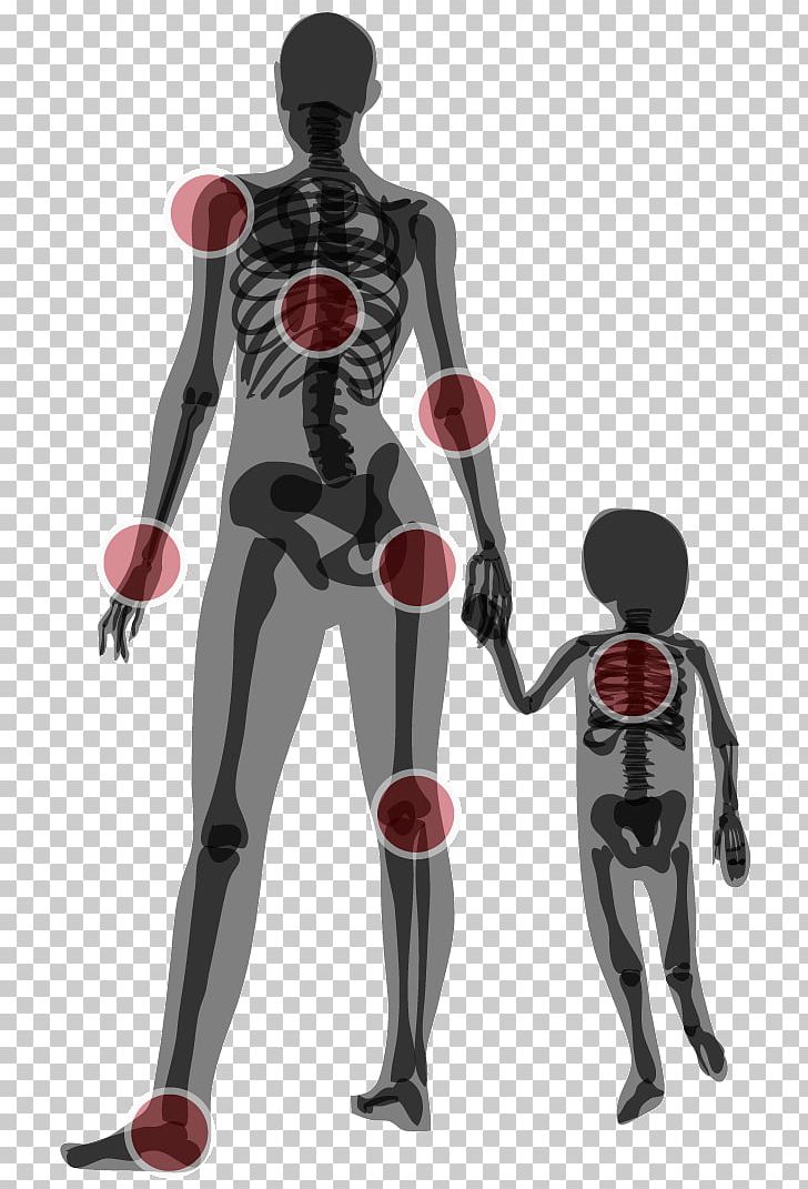 Bone Density Bone Fracture Tendon Finger PNG, Clipart, Action Figure, Bone, Bone Density, Bone Fracture, Costume Free PNG Download