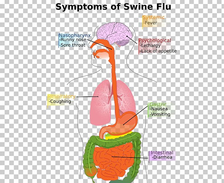 Swine Influenza Influenza A Virus Subtype H1N1 Pig Symptom PNG, Clipart,  Free PNG Download