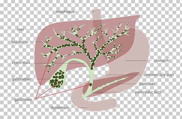 Liver And Gallbladder Gallstone Bile Gallbladder Flush PNG, Clipart, Anatomy, Bile, Bile Duct, Detoxification, Flora Free PNG Download