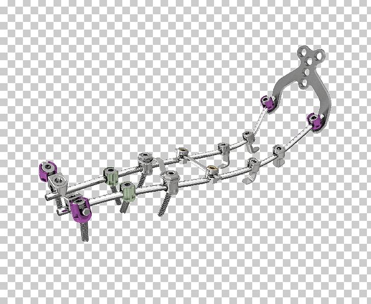 Vertebral Column Thoracic Vertebrae Surgery Stryker Corporation Spinal Cord PNG, Clipart, Auto Part, Body Jewelry, Bone, Bone Cement, Cervical Vertebrae Free PNG Download