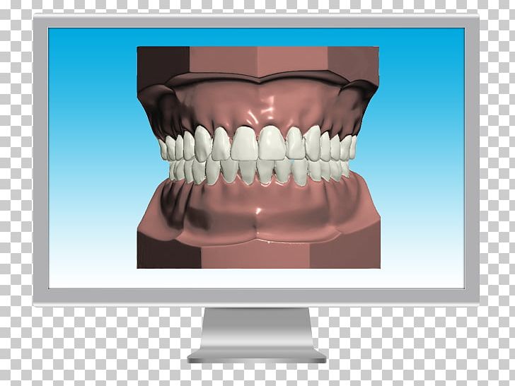 Human Tooth Jaw Mandible Animal Bite PNG, Clipart, Animal Bite, Biting, Dentist, Edentulism, Human Tooth Free PNG Download