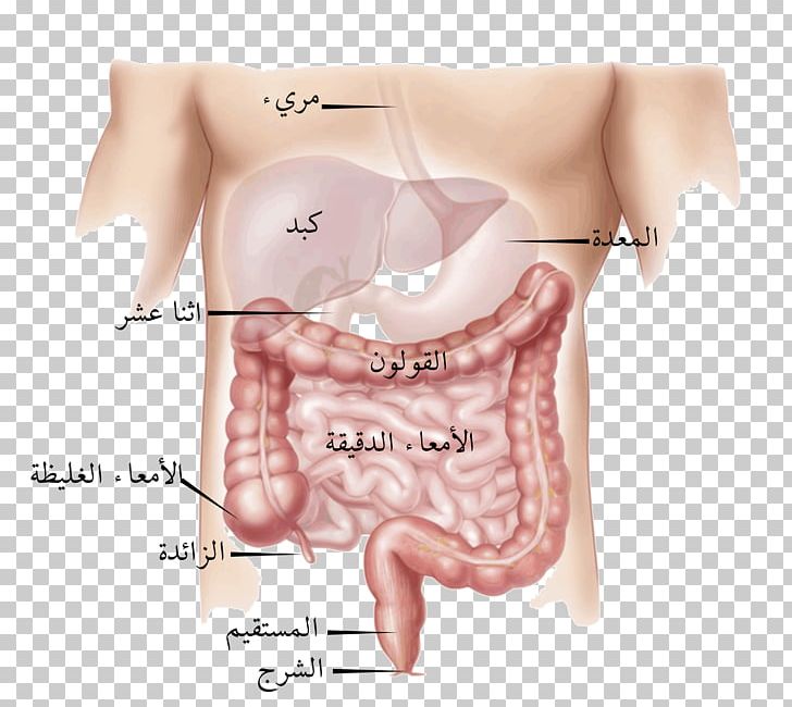 Colorectal Cancer Large Intestine Inflammatory Bowel Disease Irritable Bowel Syndrome Gastrointestinal Disease PNG, Clipart,  Free PNG Download