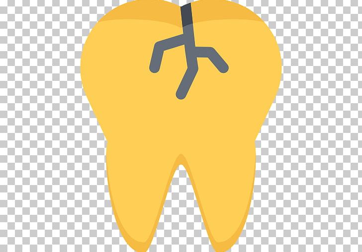 Human Tooth Tooth Decay Dentistry PNG, Clipart, Artworks, Caries, Computer Icons, Dental Abscess, Dental Surgery Free PNG Download