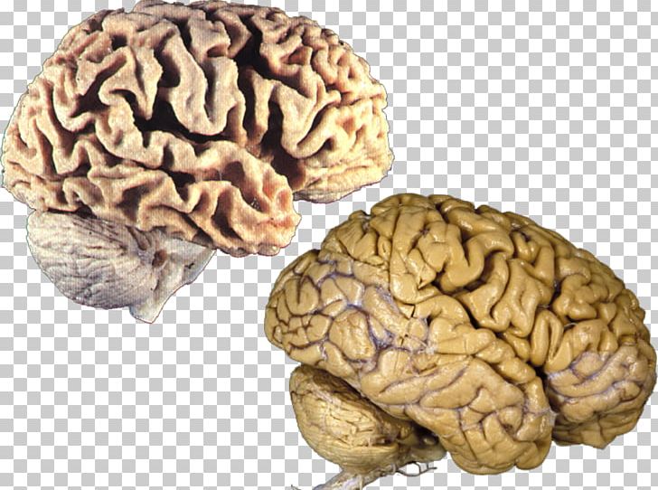 Human Brain Brain Size Anatomy PNG, Clipart,  Free PNG Download