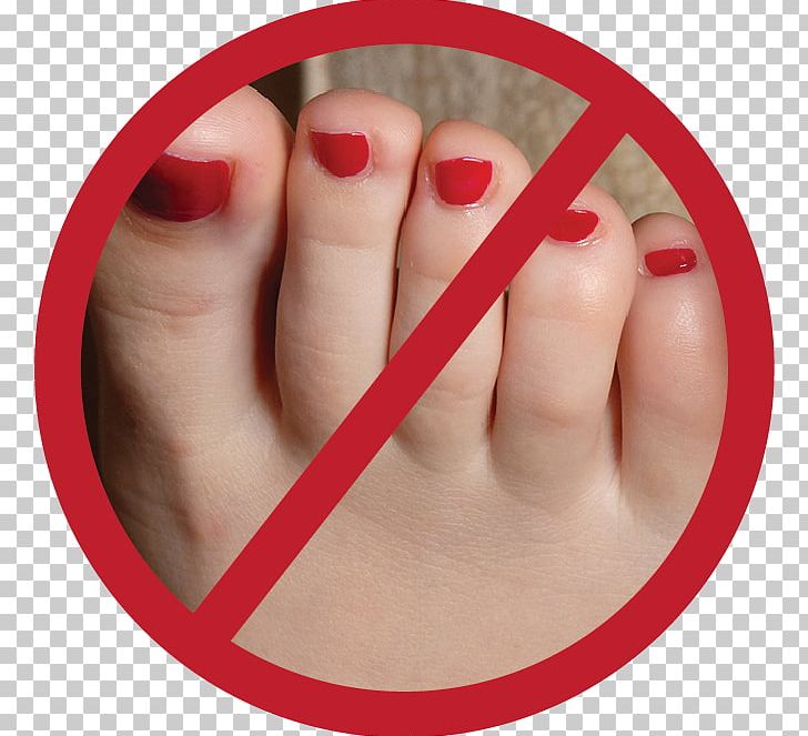 Nail Toe Foot Shoe Insert PNG, Clipart, Feet, Finger, Foot, Foot Care, Hammer Toe Free PNG Download